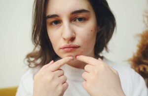 Jak pozbyć się trądziku skuteczne sposoby na zdrową skórę