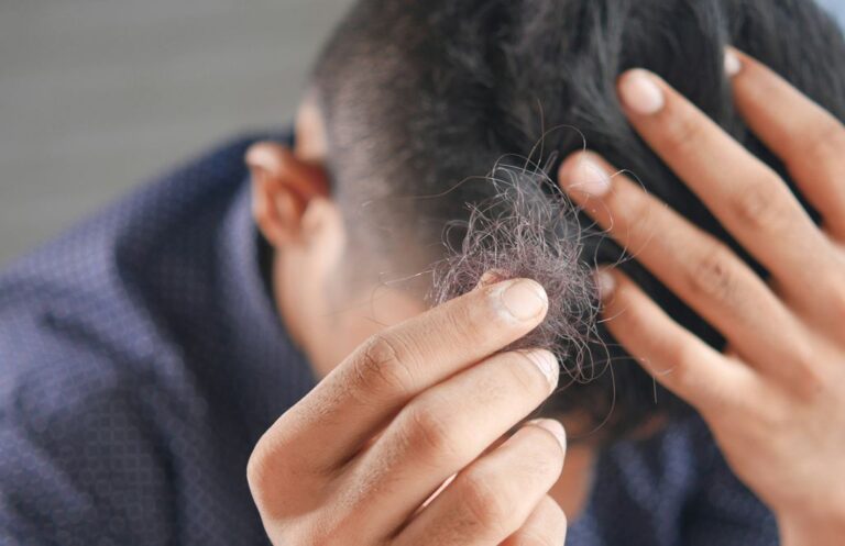 Dlaczego wypadają mi włosy - Przyczyny i walka