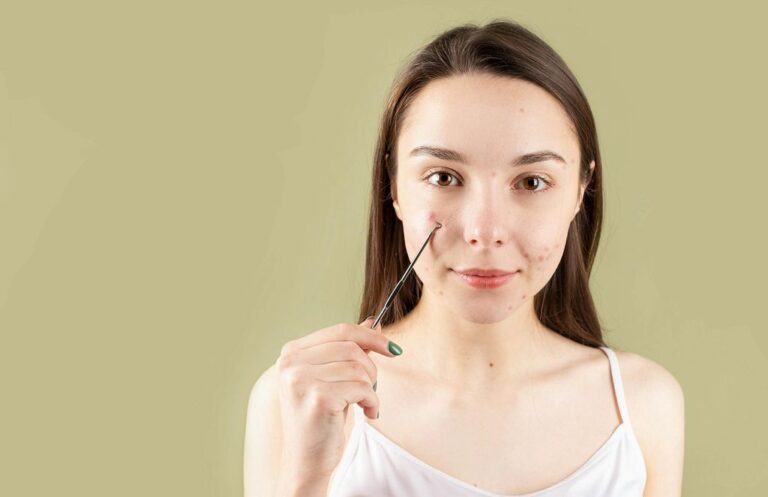 Wągry - wszystko co musisz wiedzieć