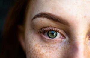 Co to są piegi i dlaczego je mam